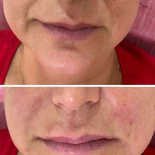 Perfect body beauty bar usluga
