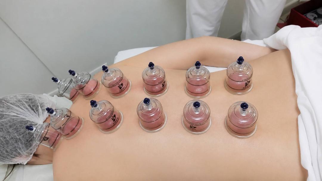 Studio Silvija #zagreb Terapeutska masaža Cupping vakuum masaža - 60 minuta