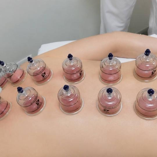 Studio Silvija #zagreb Terapeutska masaža Cupping vakuum masaža - 60 minuta Želite cjelovitiji tr