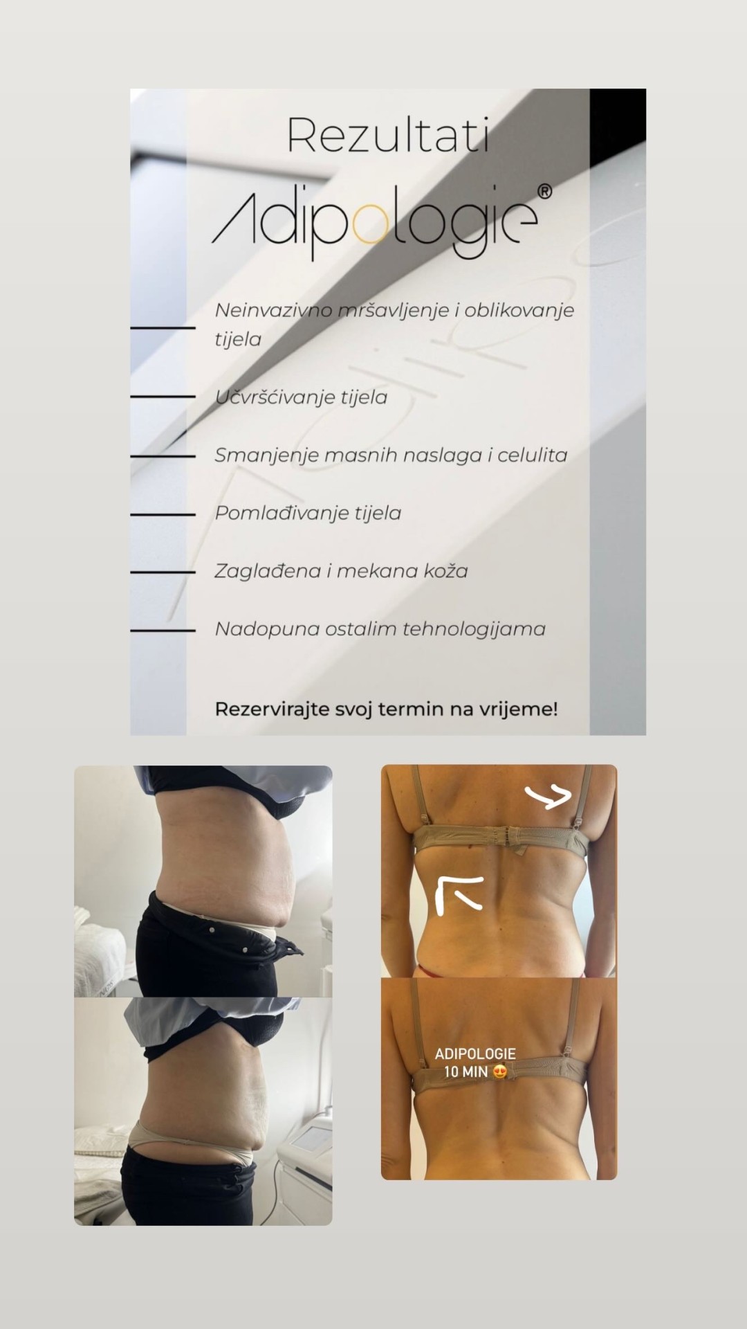 Val beauté #zagreb Anticelulit masaža Adipologie - velika regija