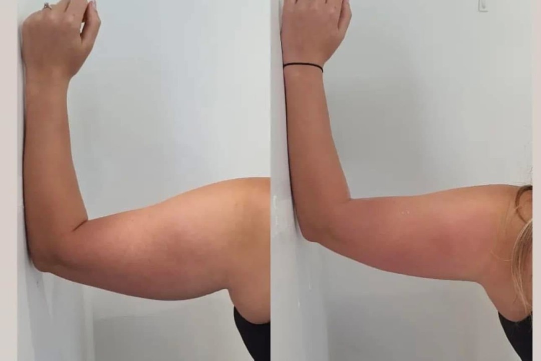 Estetix centar #zagreb