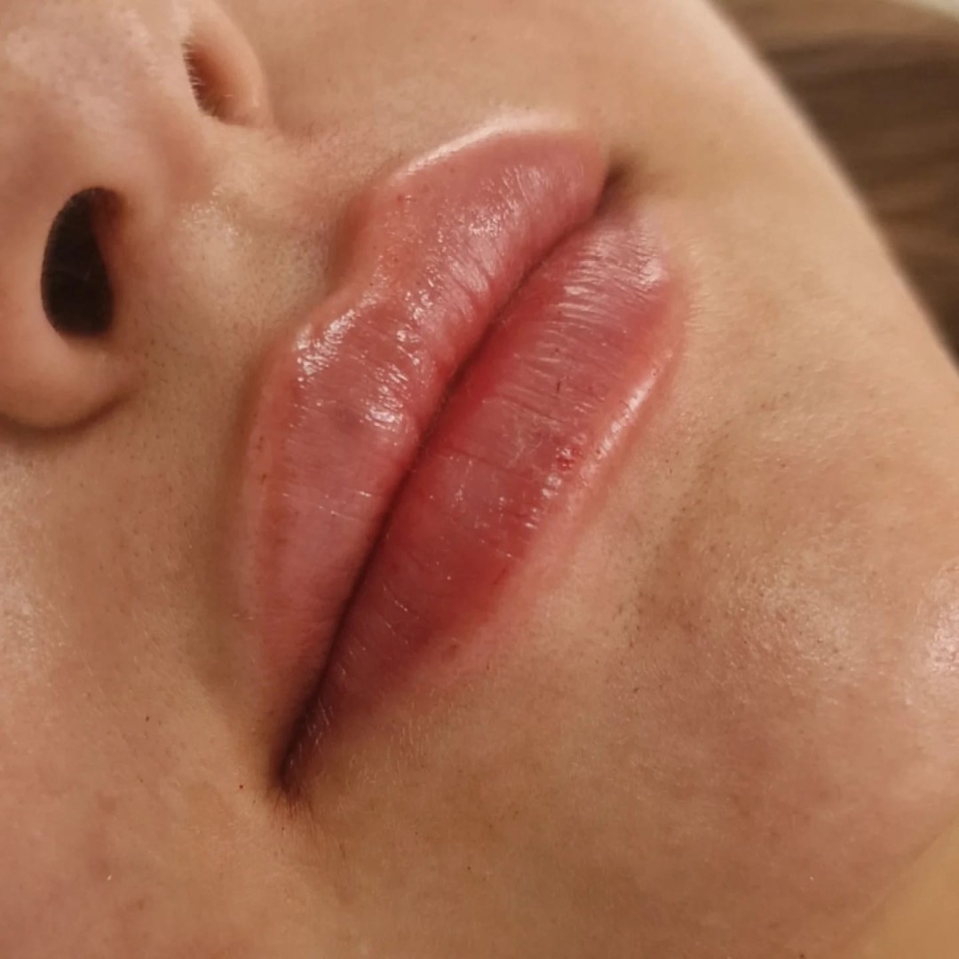 Adentis, Zagreb LookBook