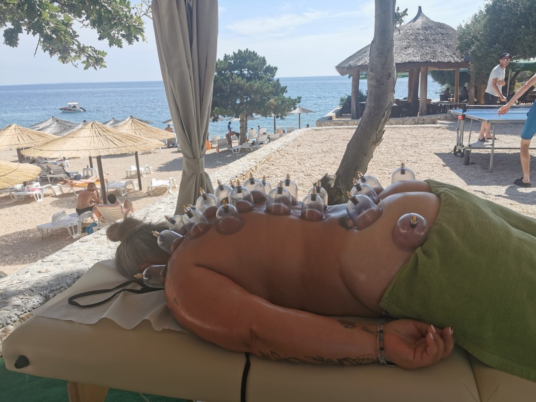 Cupping terapija + medicinska / sportska masaža - Nirvana Life Therapy, Zagreb Detoksikacija tijela Tijelo Detoksikacija tijela, Zagreb, Gornja Dubrava