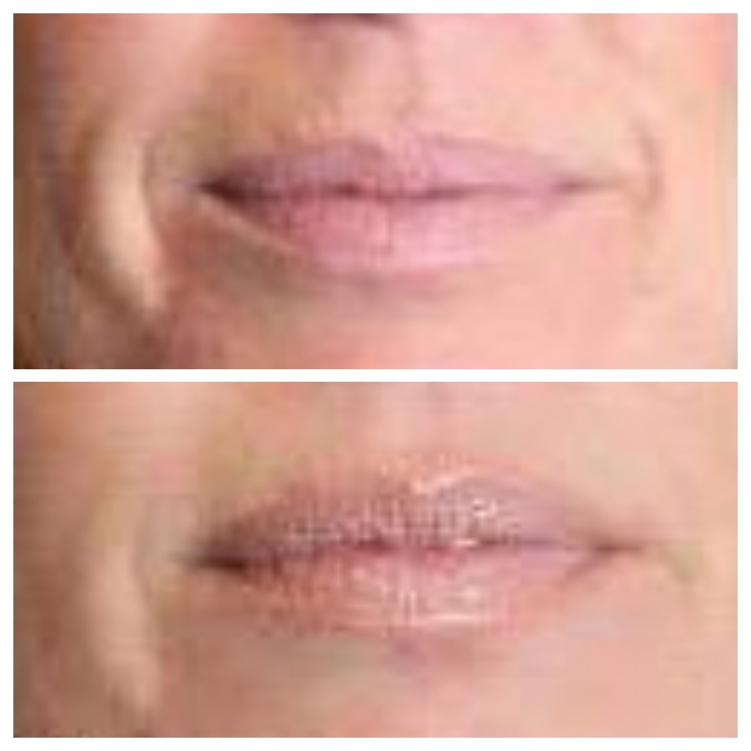 Antiage beauty room Lady Goga #zagreb Tretman lica