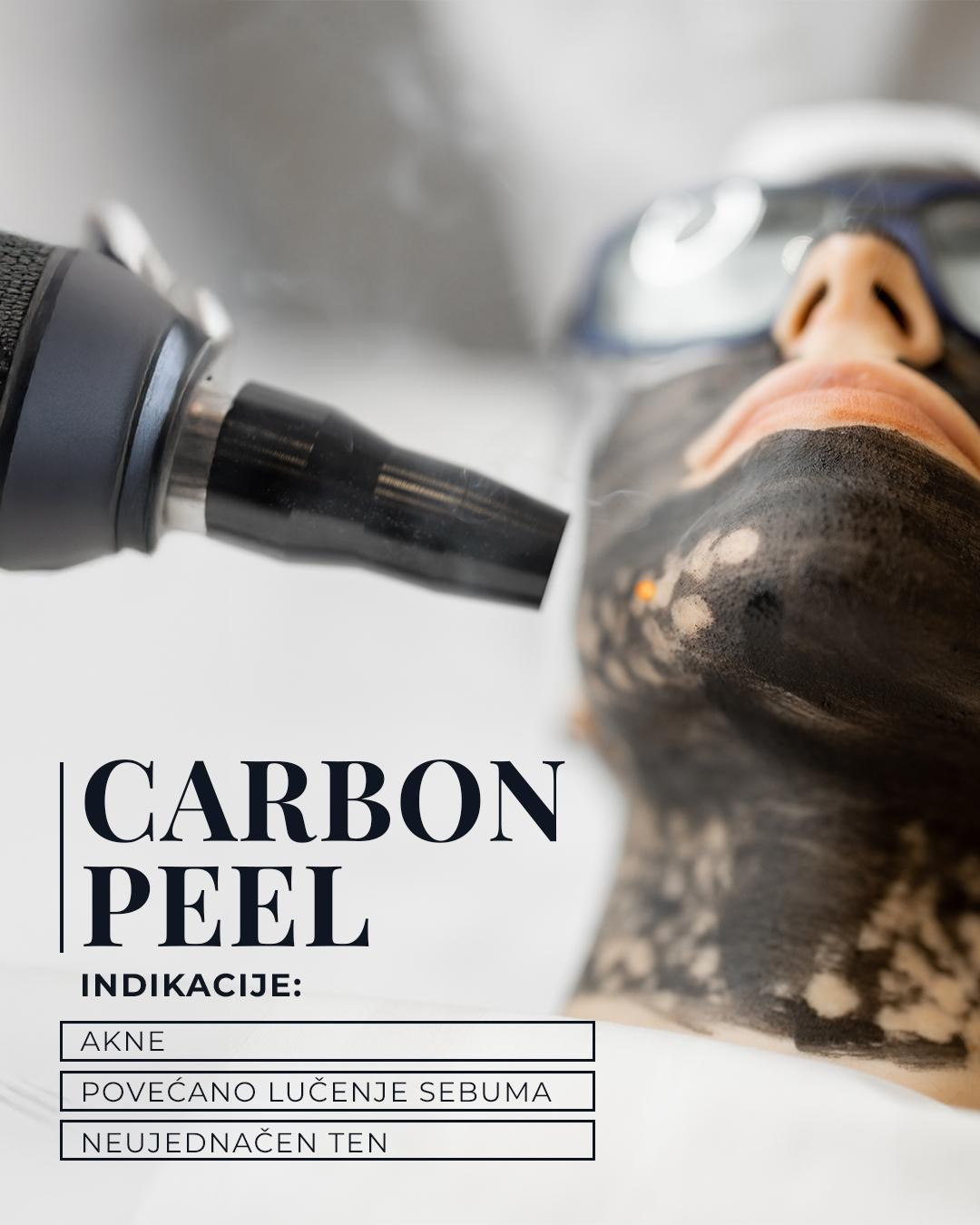 Una Victoria beauty concept #zadar Piling lica Carbon peel tretman