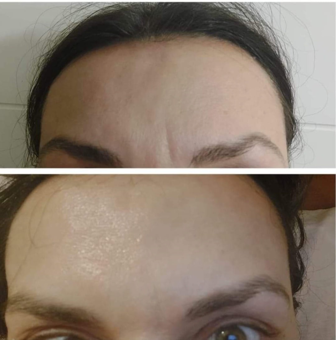 Antiage beauty room Lady Goga #zagreb Tretman lica