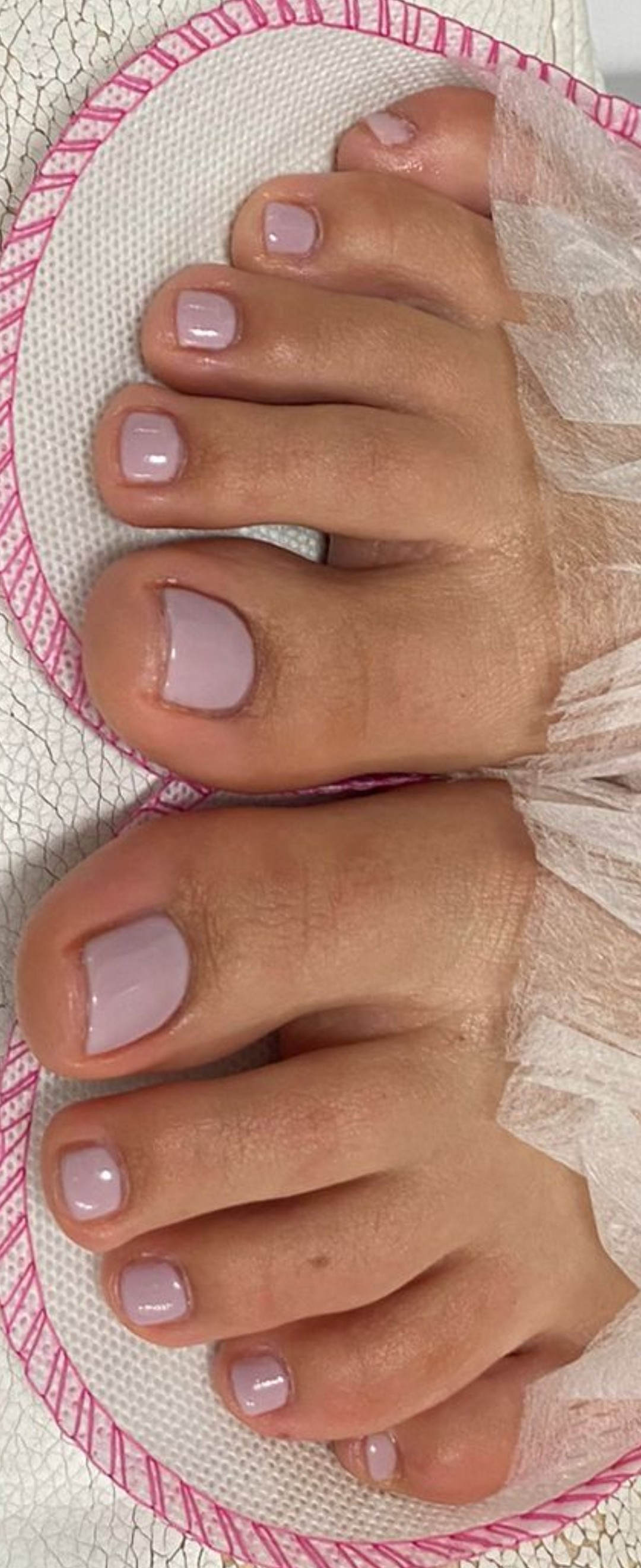 Cosmoderm & Centar Estetica #zagreb Medicinska pedikura Medicinska pedikura + trajni lak - složeni slučajevi