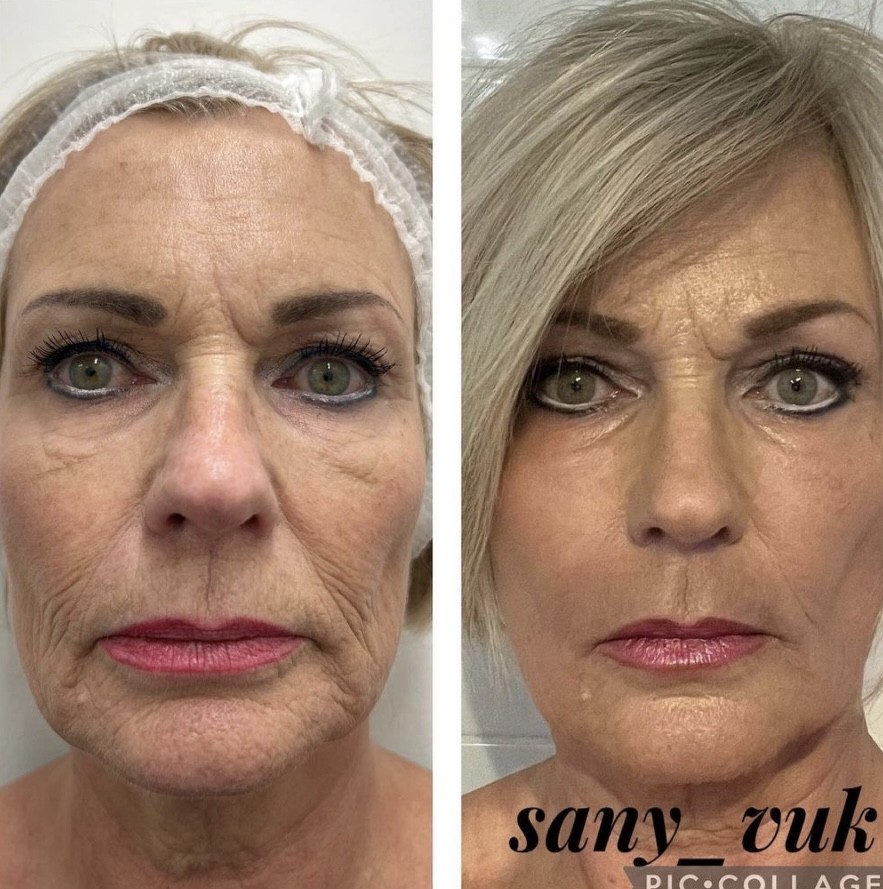 Sany Nails & Cosmetics #zagreb Tretman lica