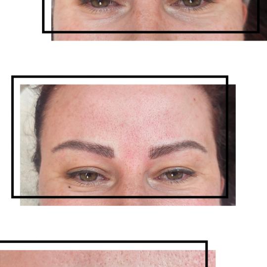 Cosmoderm & Centar Estetica usluga