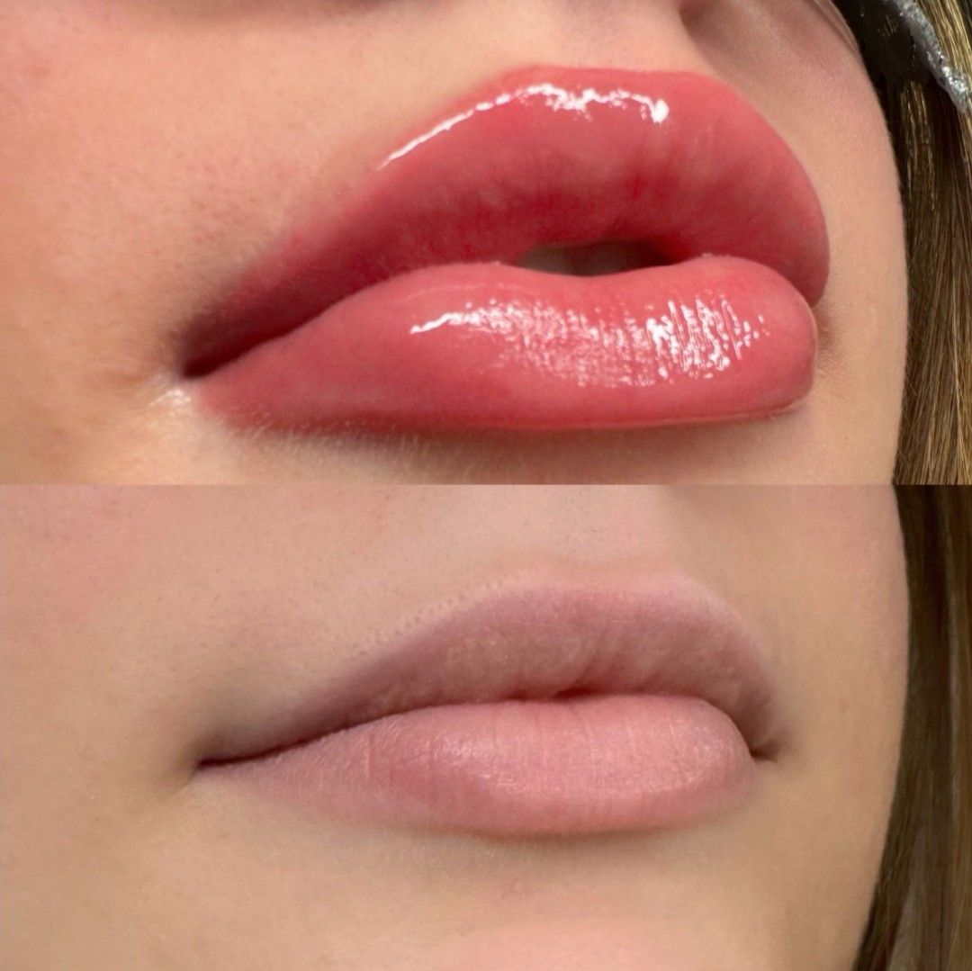 Moel beauty #zagreb Trajna šminka Mikropigmentacija usana /Lip blush