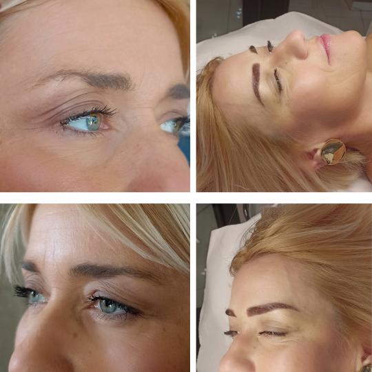 Volturi Beauty usluga