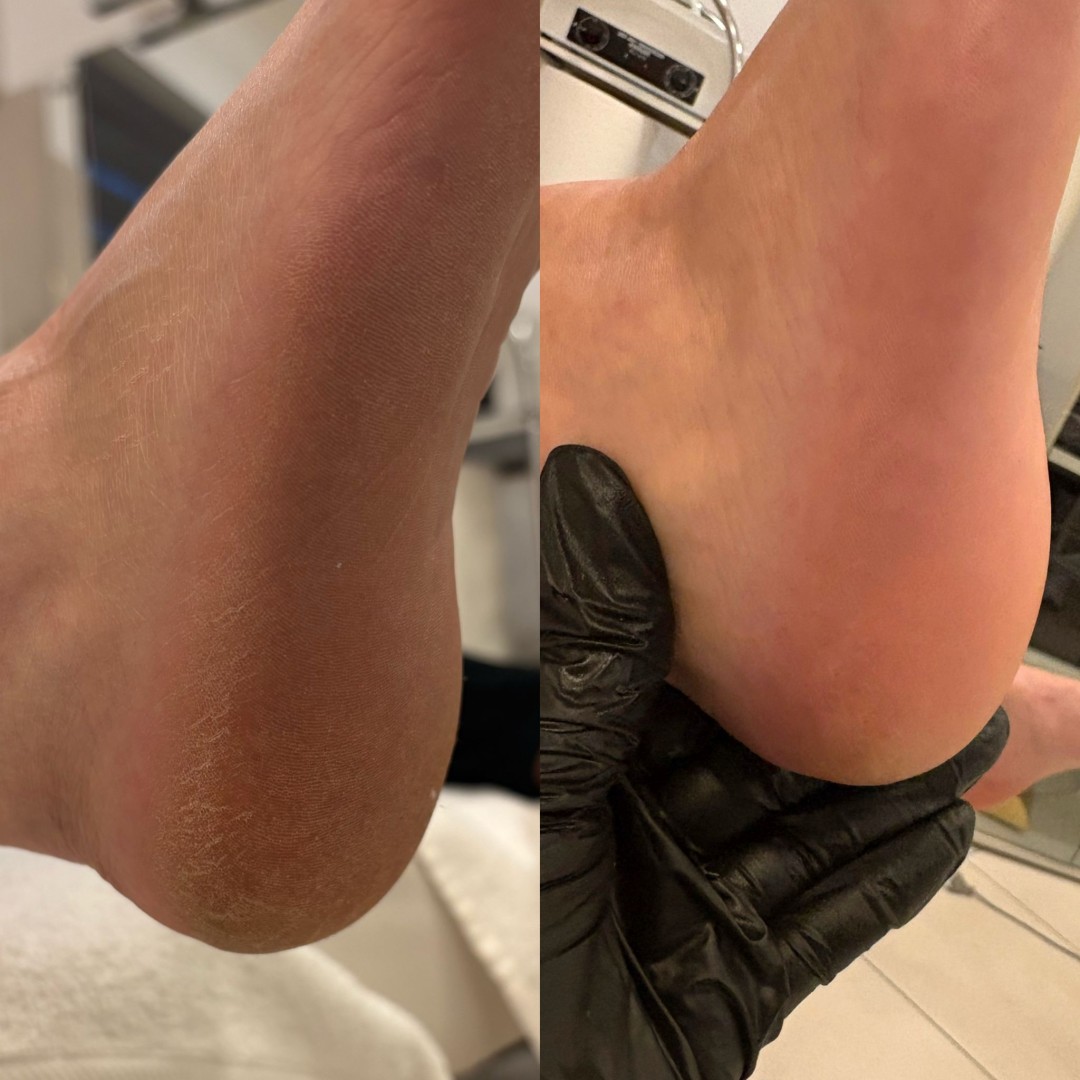 Aura #velika-gorica Estetska pedikura Ruska pedikura