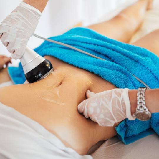 SOLO Beauty Centar #zagreb Tretmani tijela Ultrazvučna kavitacija