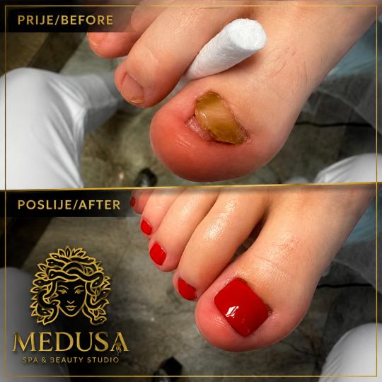 Medusa usluga