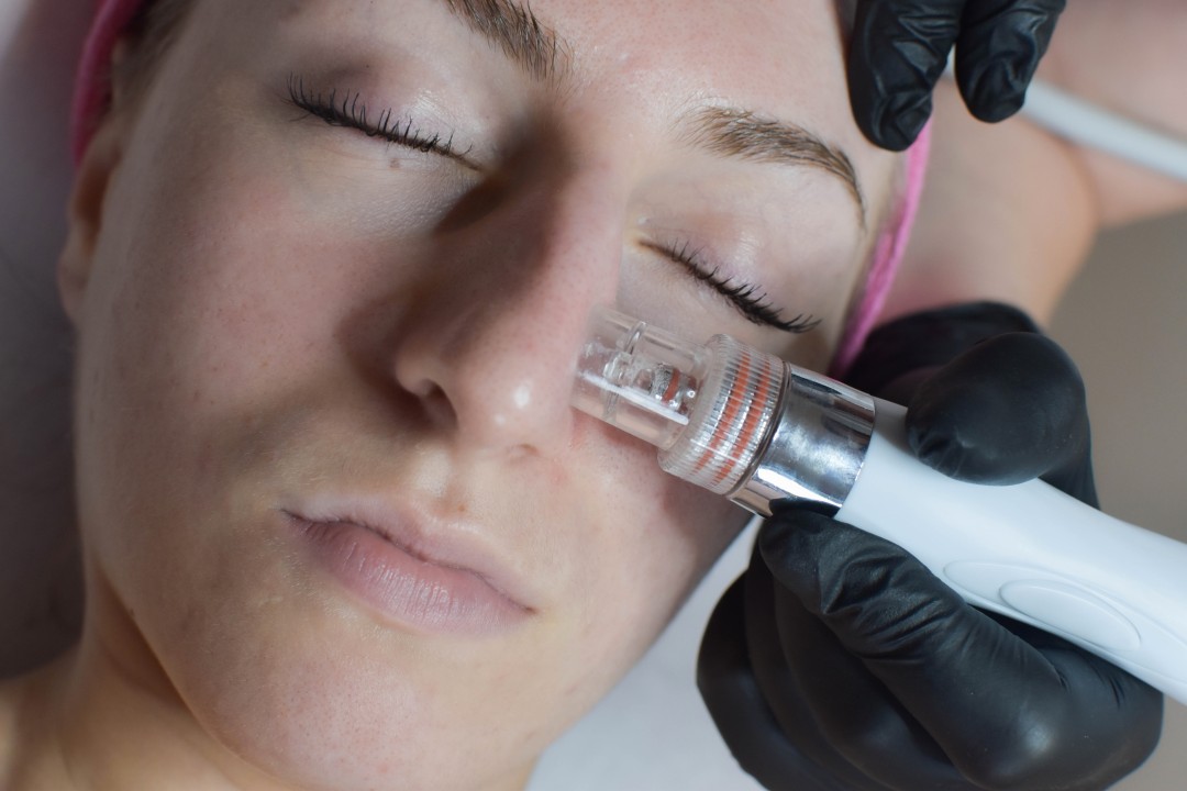 SOLO Beauty Centar #zagreb Tretman lica HydraFacial Premium