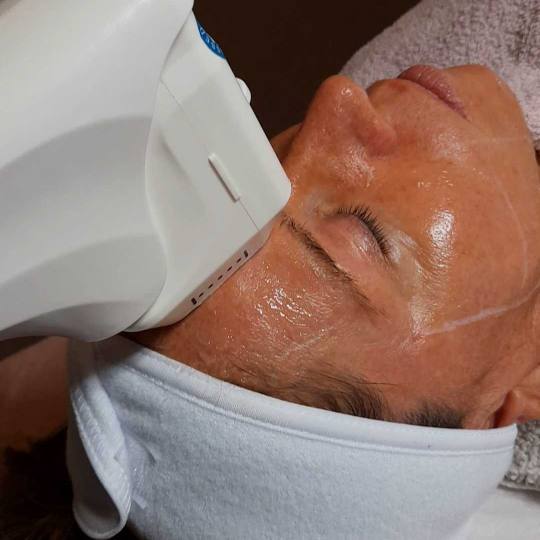 Natural #rijeka Tretman lica HIFU podizanje obrva