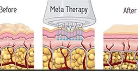 Antiage beauty room Lady Goga #zagreb Tretman lica