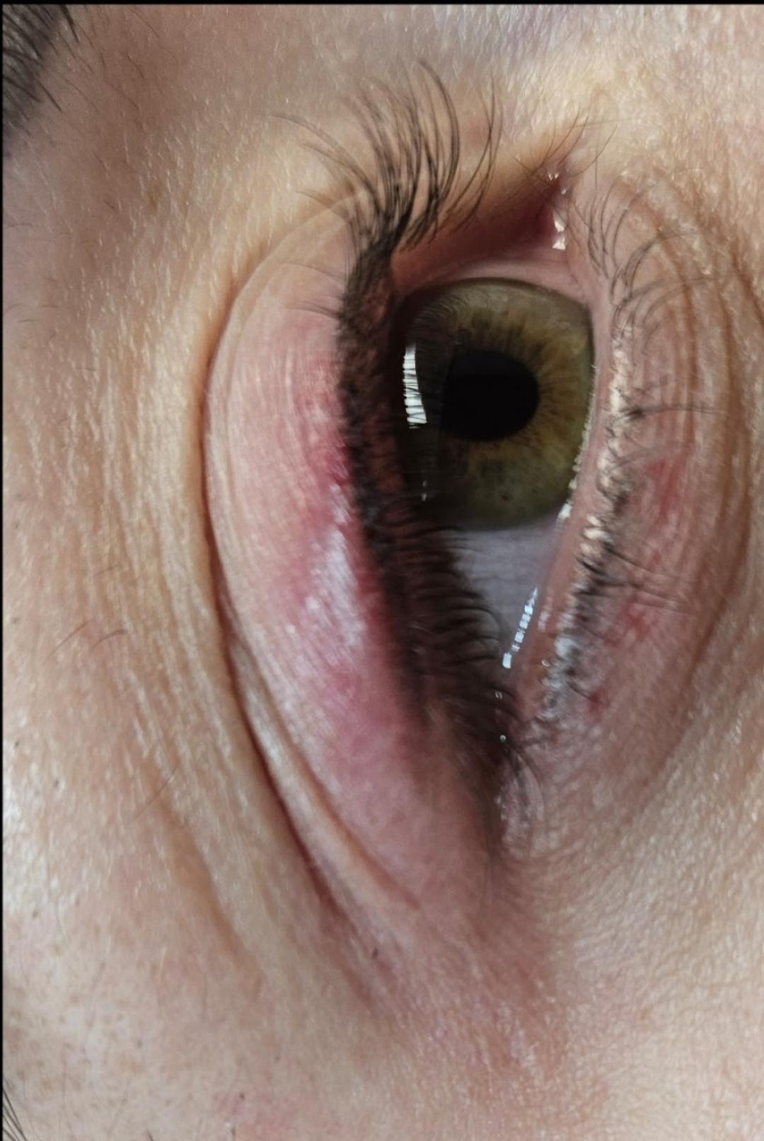 Cosmoderm & Centar Estetica #zagreb Trajna šminka Trajna šminka - eyeliner - linija s repićem