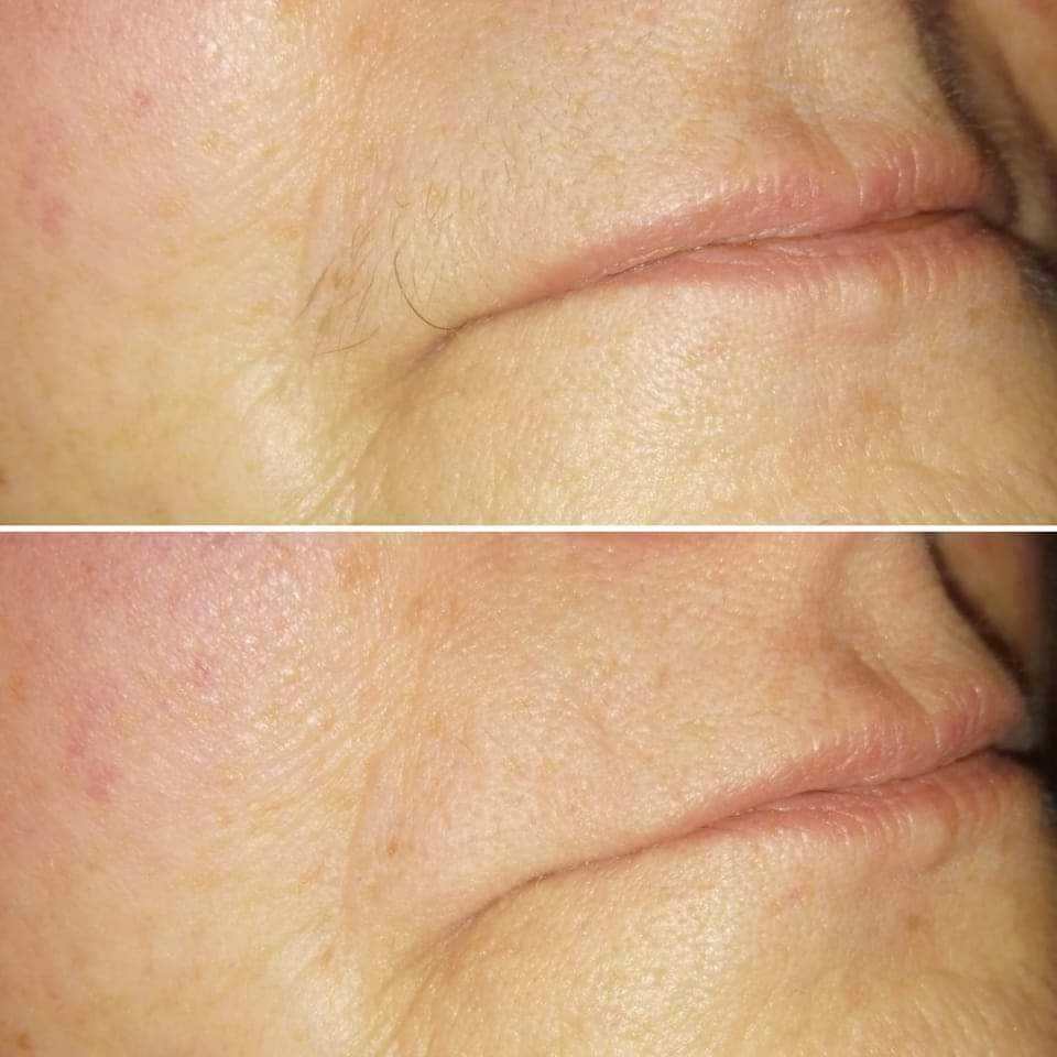 Gentle Beauty Atelier #slavonskibrod Depilacija voskom Depilacija nadusnica koncem - za dame