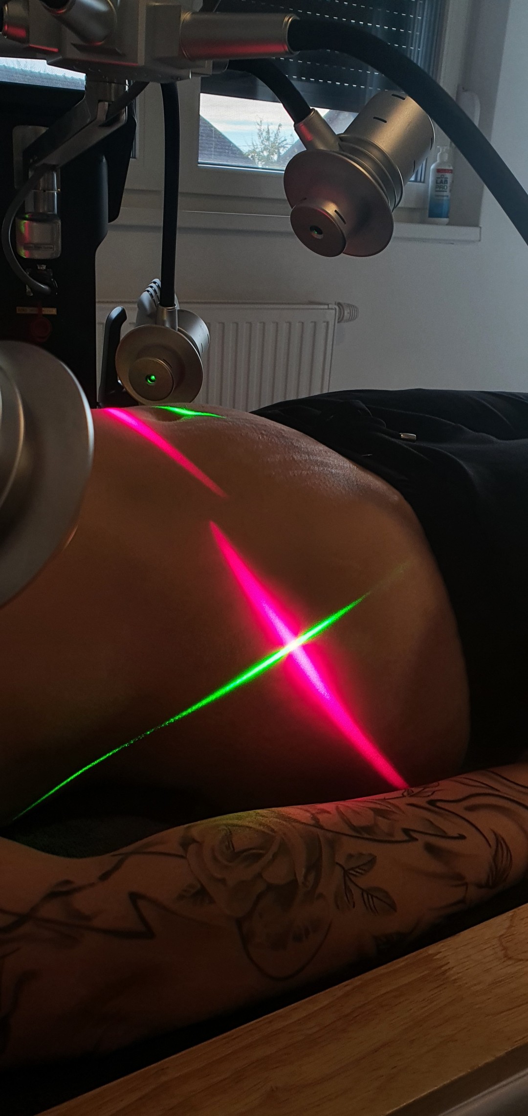 SOLO Beauty Centar #zagreb Tretmani tijela 6D LIPO laser pro tretman - 45 minuta