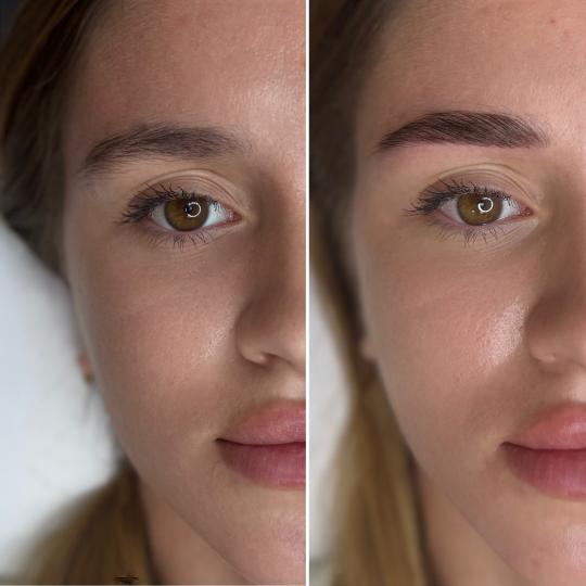 Anova Aesthetics #zagreb Obrve Brow lift + bojanje + oblikovanje obrva
