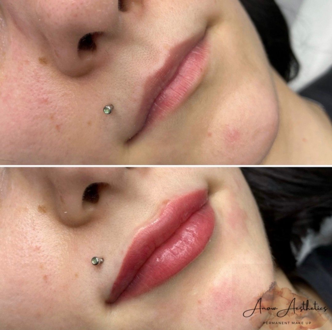 Trajna šminka - usne - Anova Aesthetics, Zagreb Trajna šminka Lice Trajna šminka, Zagreb, Trešnjevka – jug