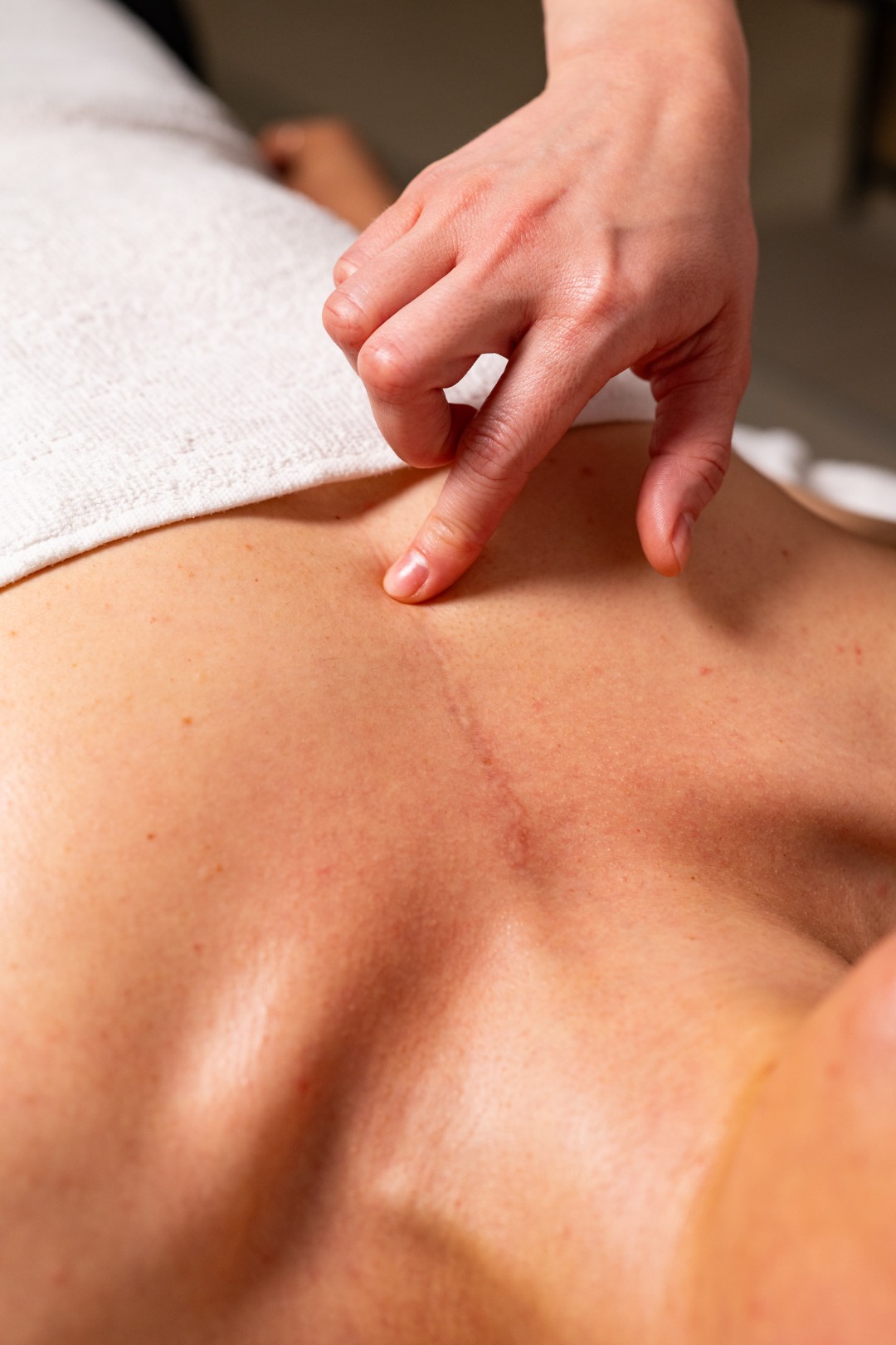 In Statera #zagreb Tretmani tijela Tretman ožiljaka