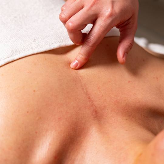 In Statera #zagreb Tretmani tijela Tretman ožiljaka