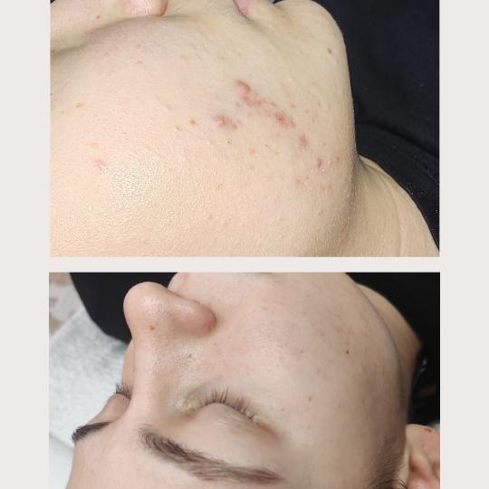 Valena estetica usluga