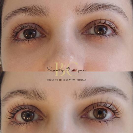 Beauty Clinique #zagreb