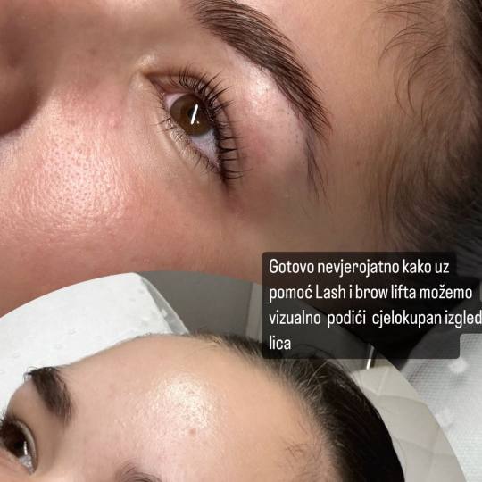 MOELL beauty #zagreb Trepavice Lash lift + bojanje + 3D filler Lash lift