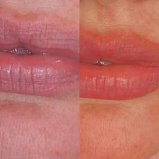 Antiage beauty room Lady Goga usluga