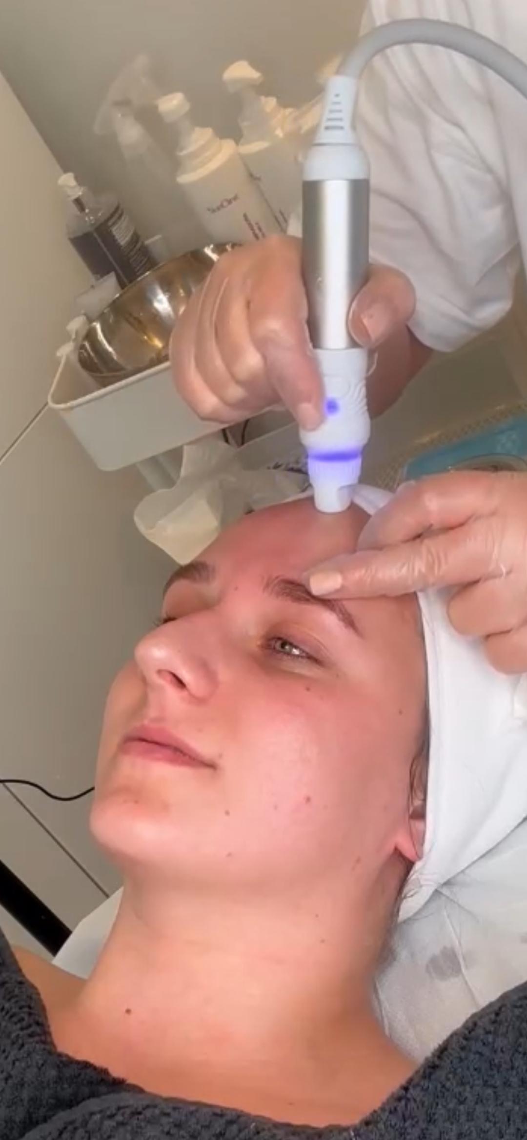 Evi #zagreb Tretman lica Hidrafacial dubinski tretman lica - hidralux