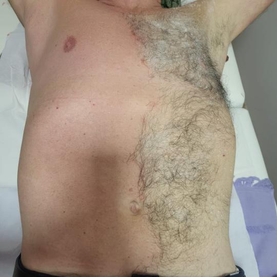More love beauty #zagreb Estetska pedikura Depilacija prsa za muškarce