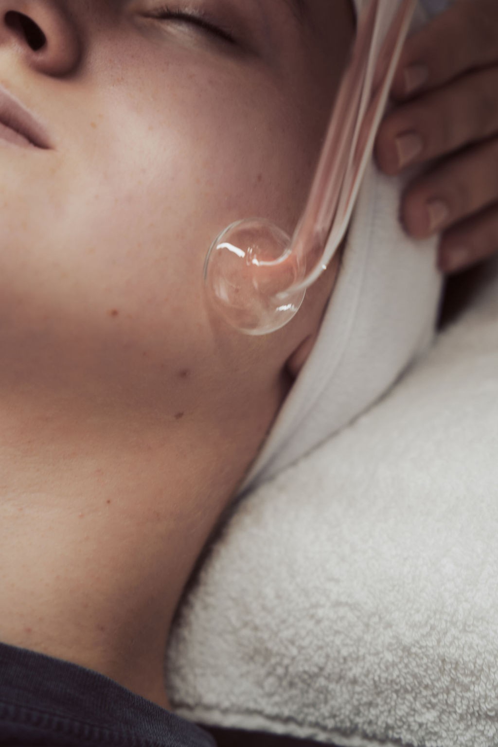 Visoka frekvencija - dodatak uz uslugu - Skinergy, Zagreb Radiovalni i ultrazvučni tretmani Tijelo Radiovalni i ultrazvučni tretmani, Zagreb, Novi Zagreb – zapad