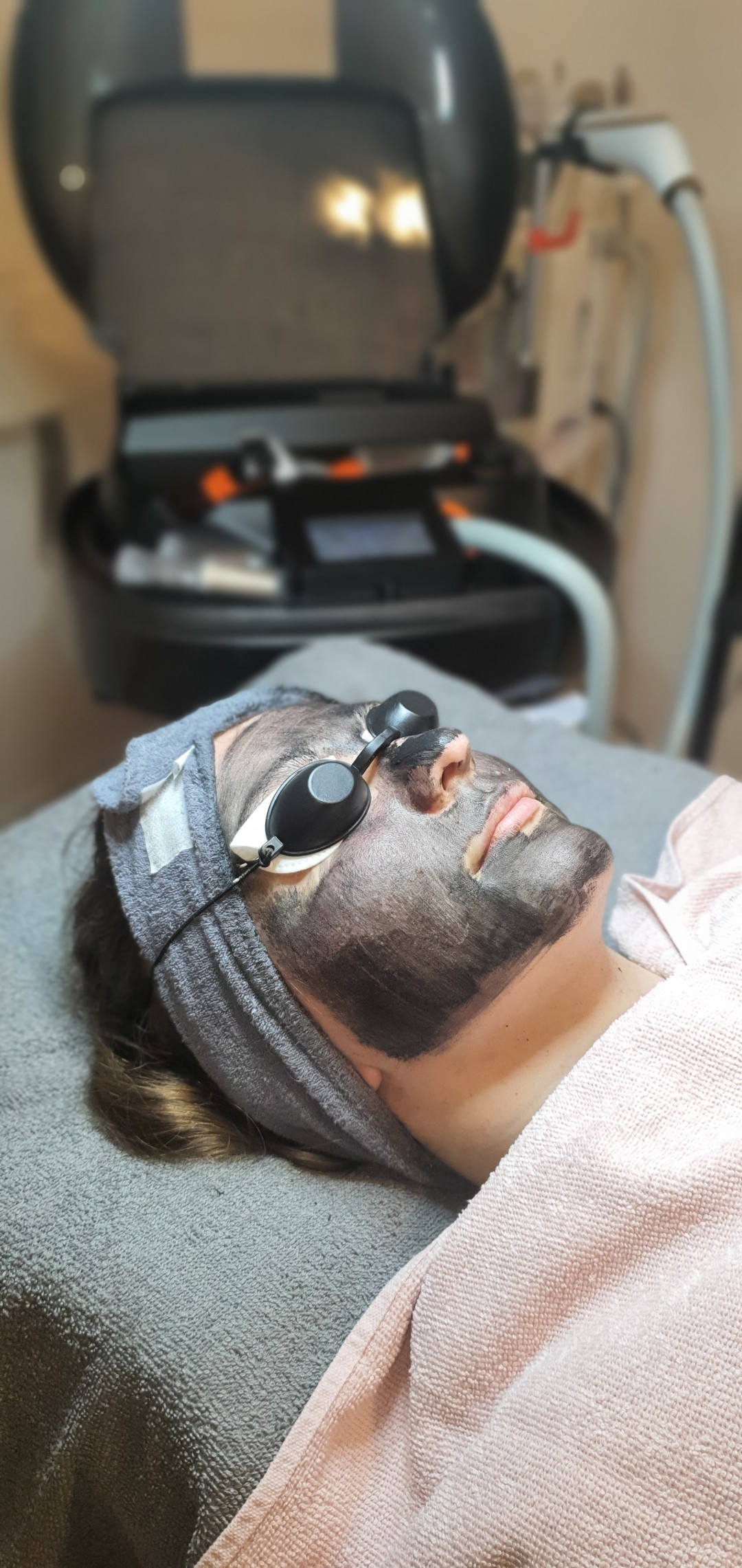 SOLO Beauty Centar #zagreb Laserski tretmani lica Black Doll -carbon peel