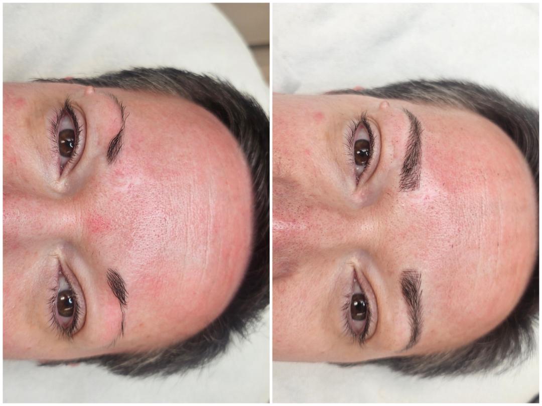 Trajna šminka - iscrtavanje dlačica (hiper realistične obrve) - Cosmoderm & Centar Estetica, Zagreb Trajna šminka Lice Trajna šminka, Zagreb, Trnje