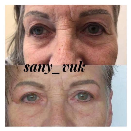 Sany Nails & Cosmetics #zagreb Tretman lica  ACCOR Cosmetics Corrector je nježna alternativa operac