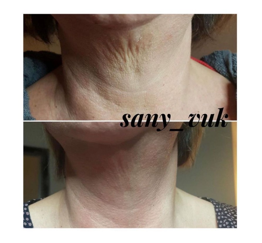 Sany Nails & Cosmetics #zagreb Tretman lica