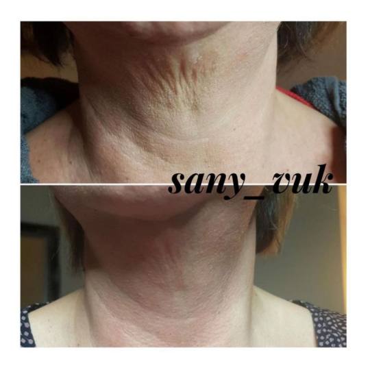 Sany Nails & Cosmetics #zagreb Tretman lica  ACCOR Cosmetics Corrector je nježna alternativa operac