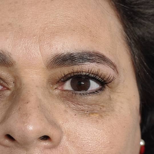 Glow Differently usluga