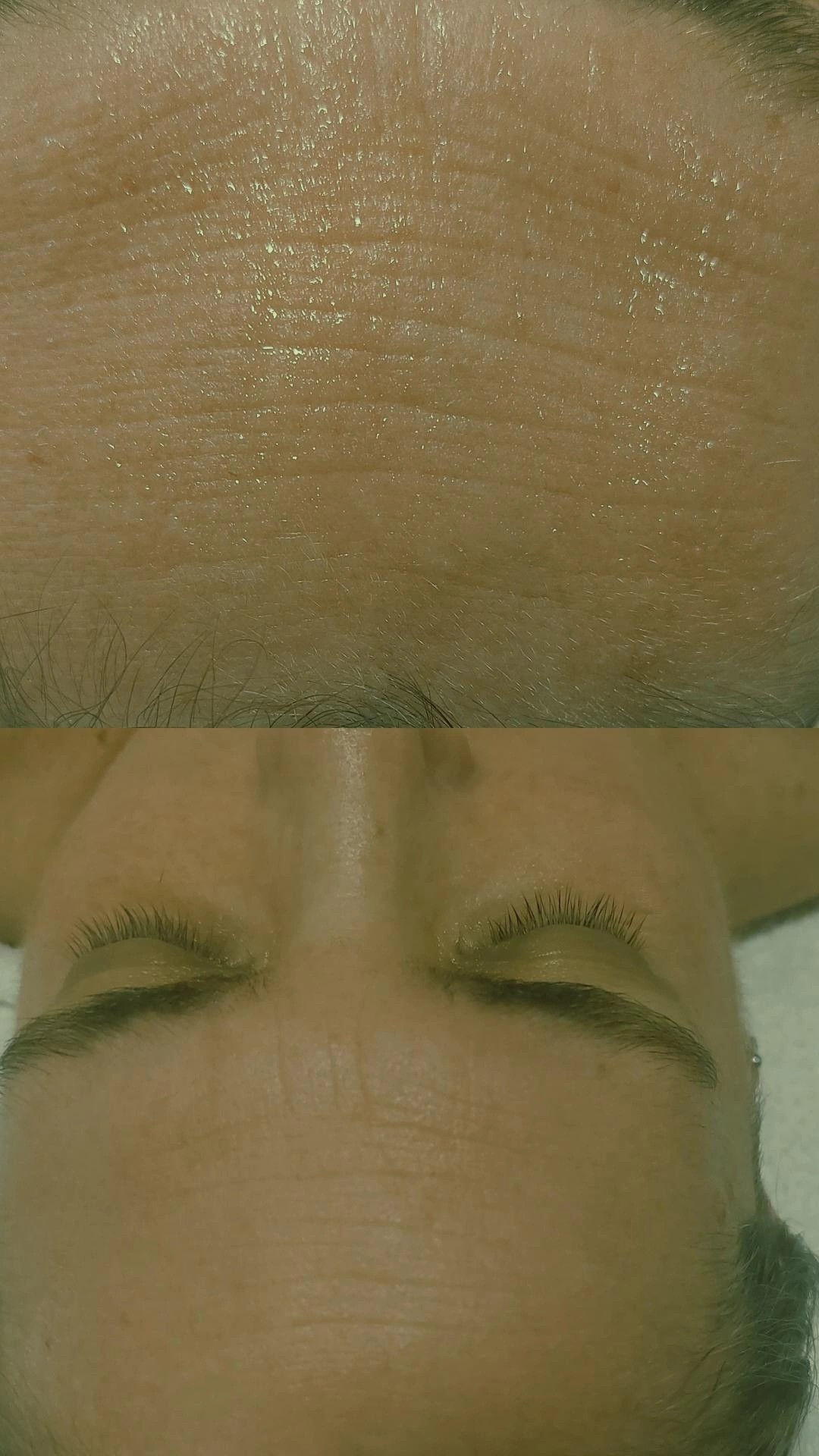 Antiage beauty room Lady Goga #zagreb Tretman lica