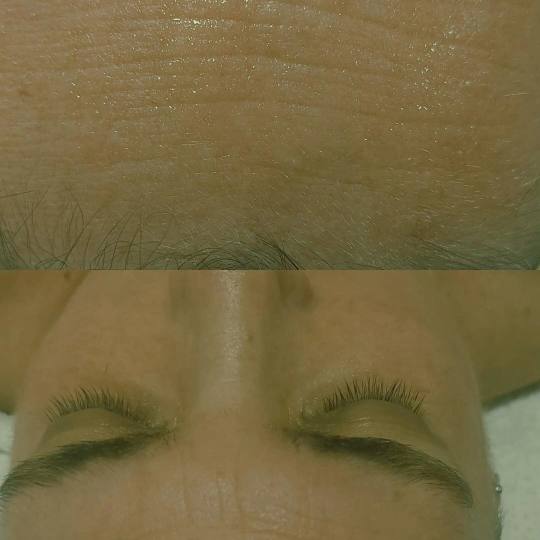 Antiage beauty room Lady Goga #zagreb Tretman lica