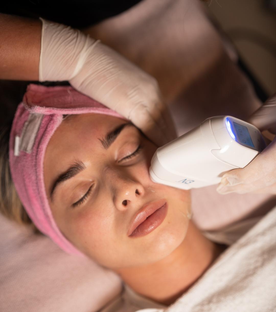 SOLO Beauty Centar #zagreb Tretman lica HIFU tretman - cijelo lice