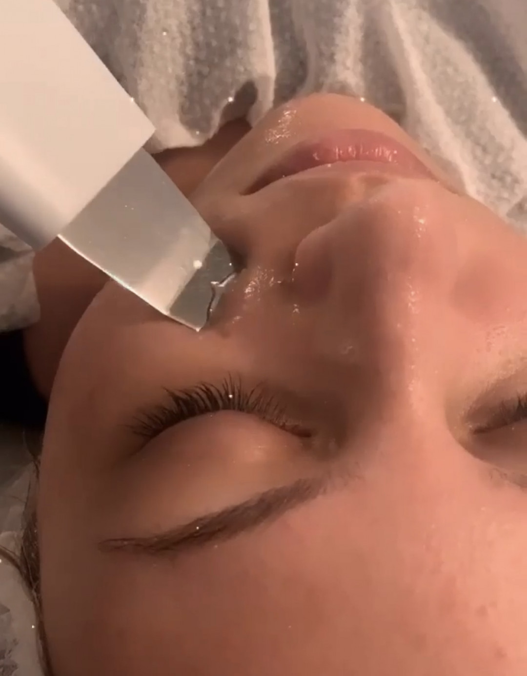 Mint Beauty Boutique #zagreb Tretman lica Deep Cleanse - UZ čišćenje + Peeling + Mehaničko čišćenje + Terapija kisikom + LED