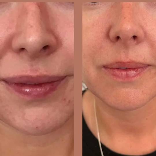 Estetix centar usluga