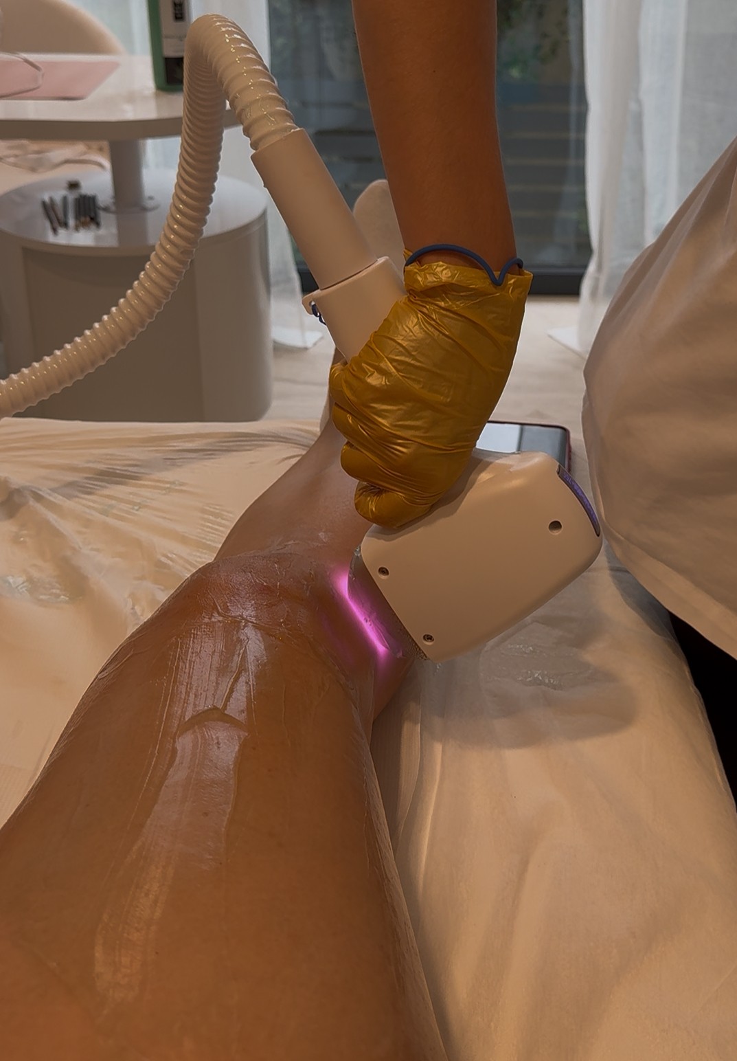 SABRINA STRIJA BEAUTY & SPA #zagreb Laserska epilacija Laserska epilacija cijelog tijela za dame - paket od 10 tretmana