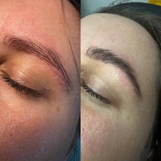 Studio Nives #zagreb Obrve Brow lift Brow lift je tretman podizanja obrva, kako bi obrve bile elasti