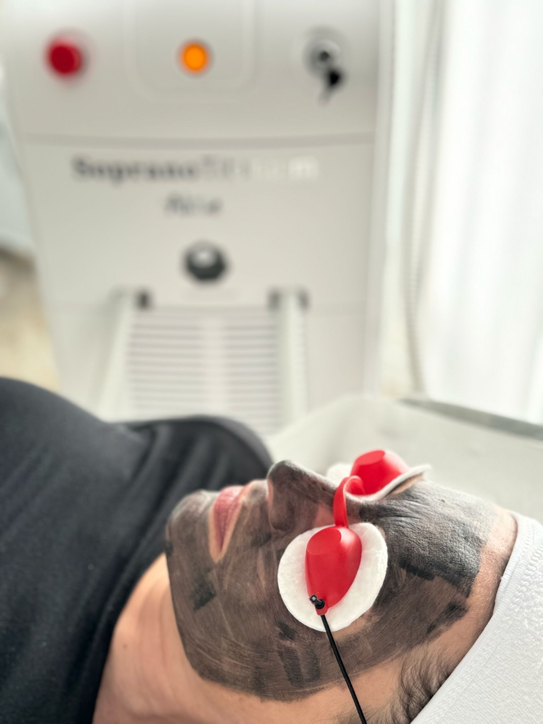 S M Beauty Bloom #zadar Depilacija šećernom pastom Black peel - tretman lica