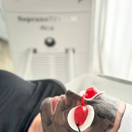 S M Beauty Bloom #zadar Depilacija šećernom pastom Black peel - tretman lica